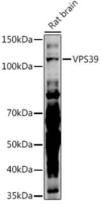 Western Blot: VPS39 Antibody [NBP2-94302] - Western blot analysis of extracts of Rat brain, using VPS39 antibody (NBP2-94302) at 1:500 dilution. Secondary antibody: HRP Goat Anti-Rabbit IgG (H+L) at 1:10000 dilution. Lysates/proteins: 25ug per lane. Blocking buffer: 3% nonfat dry milk in TBST. Detection: ECL Basic Kit. Exposure time: 180s.